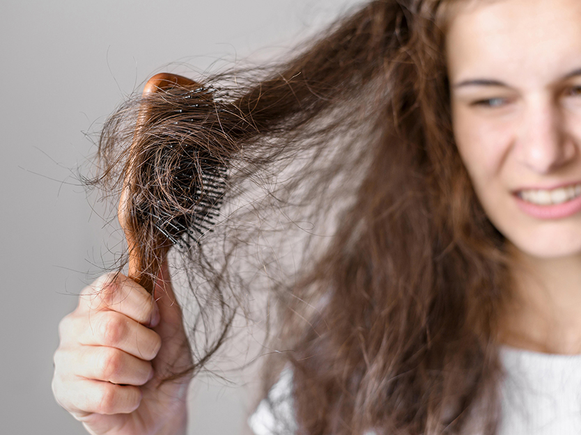 pelo verano